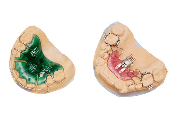 Palatal-Expander